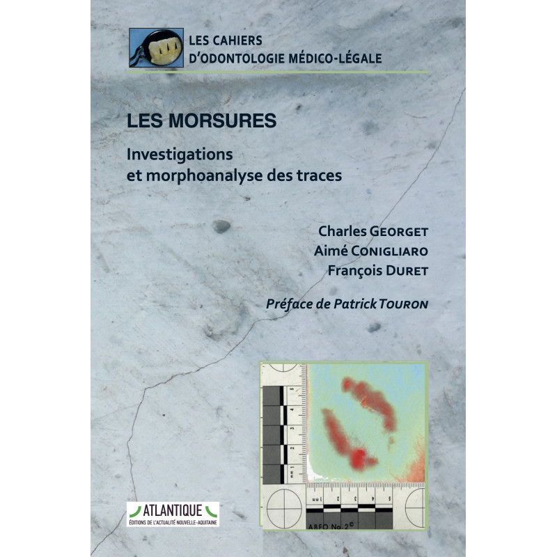 Les morsures : investigations et morpho-analyse des traces