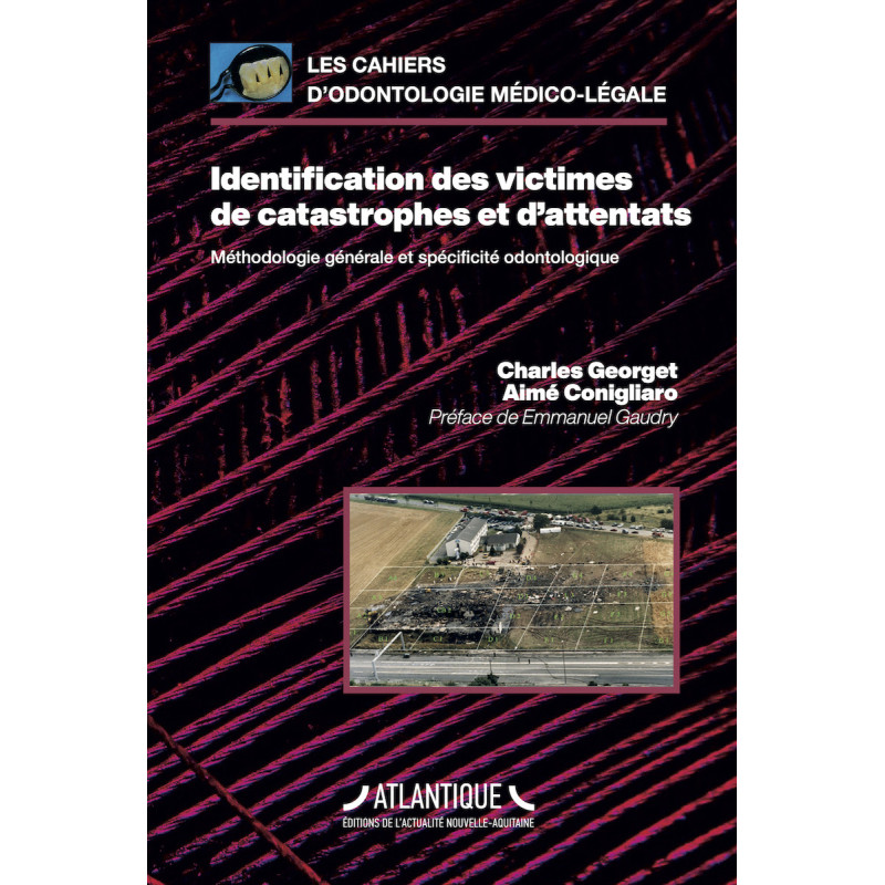 Identification des victimes de catastrophes et d’attentats - Méthodologie générale et spécificité odontologique